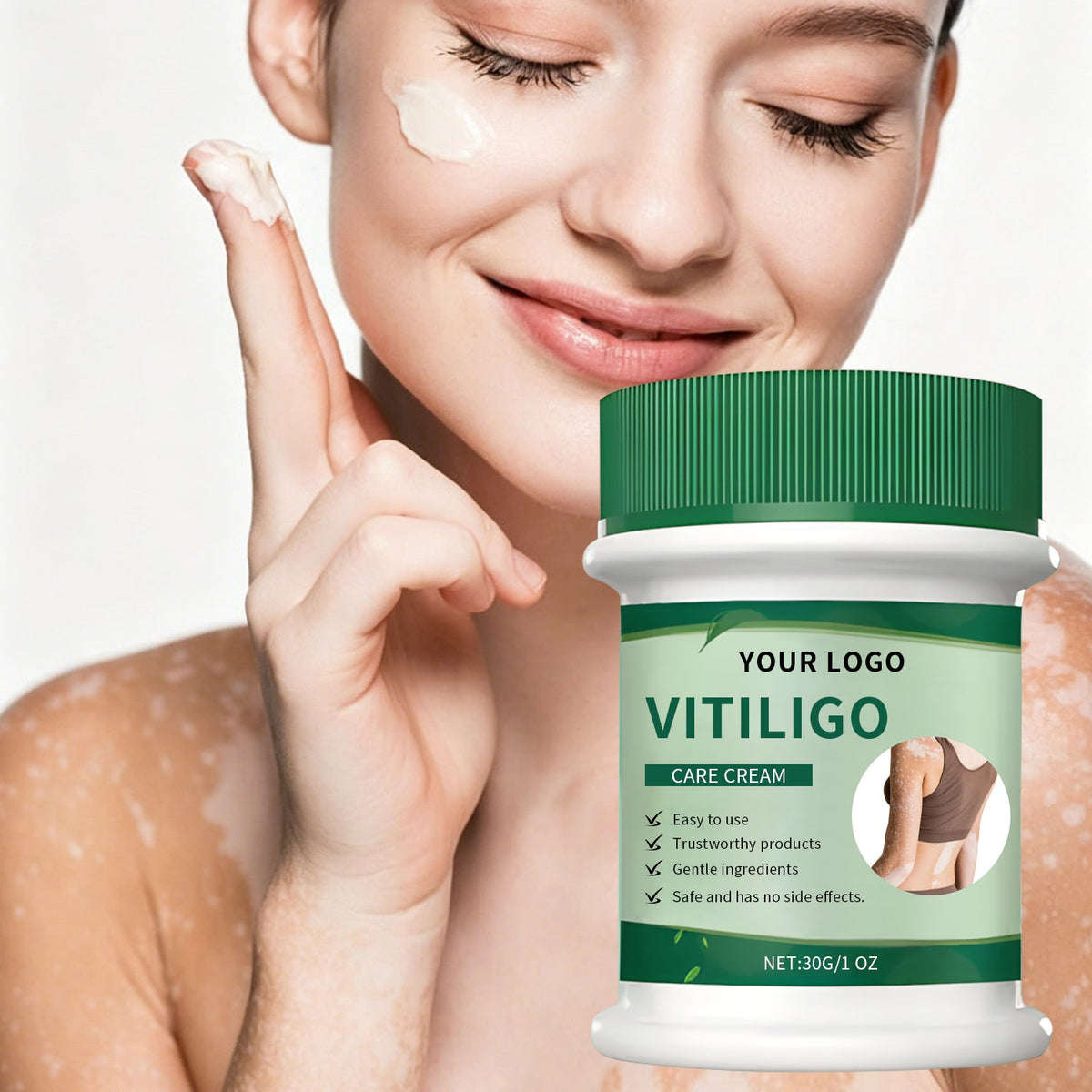 Vitiligo Herbal Aloe Vera & Mint Care Cream